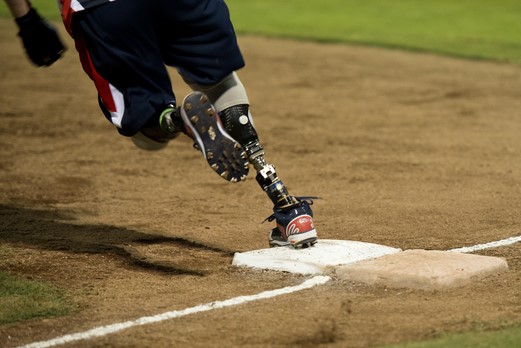 man with prosthesis rounding base during softball game